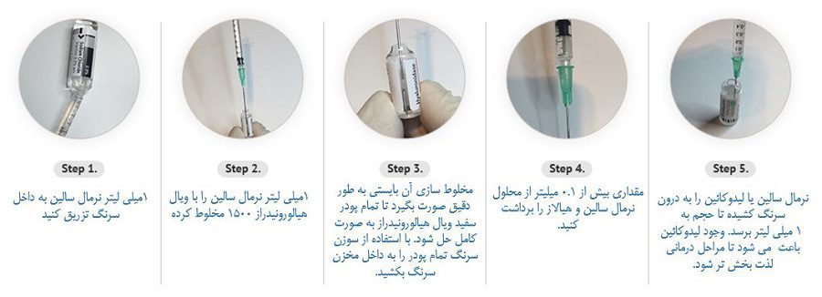 کاربرد هیالورونیداز آمپول هیالورونیداز