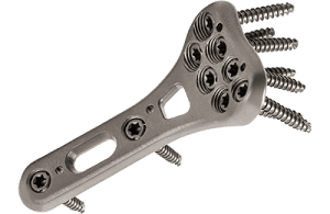 پلاک ارتوپدی چیست؟ راهنمای کامل انواع و کاربردها پلاک ارتوپدی