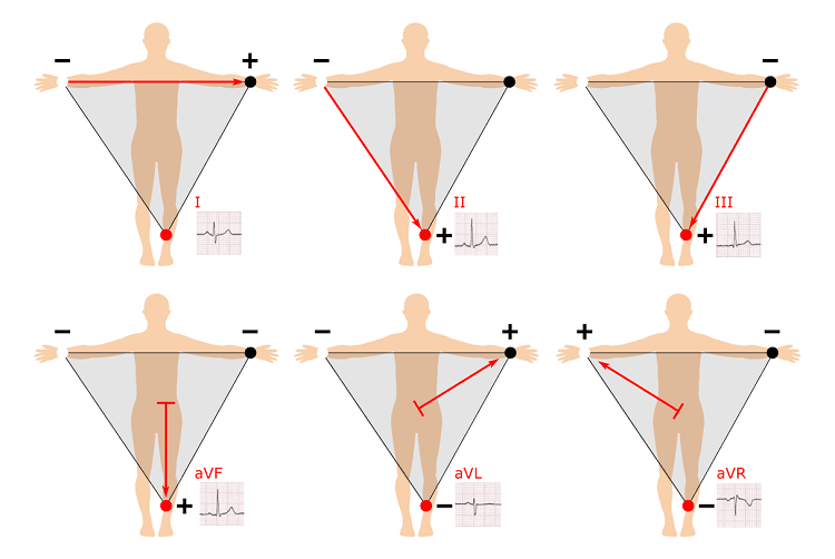 از سیر تا پیاز دستگاه الکتروکاردیوگرام (ECG) دستگاه نوار قلب