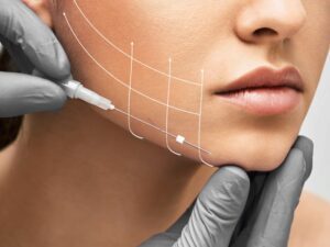 راهنمای کامل لیفتینگ صورت لیفتینگ صورت