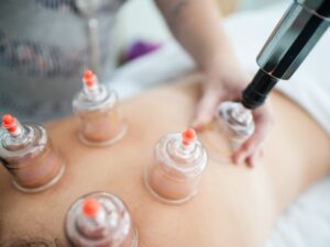 اقداماتی که باید قبل و بعد از حجامت انجام دهید قبل و بعد حجامت