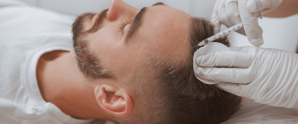 تکنیک مزوتراپی و آنچه باید در مورد این روش درمانی بدانید مزوتراپی