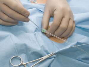 استفاده سوند