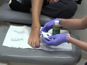 بتادین چیست و چه کاربردی دارد؟ بتادین و کاربرد آن