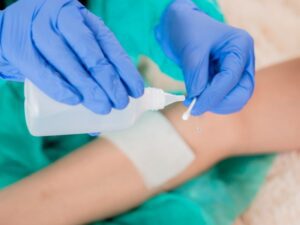 آشنایی با انواع ضدعفونی کننده زخم انواع ضدعفونی کننده زخم ها