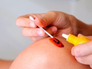 آیا بتادین خراب میشود؟ آیا بتادین خراب میشود؟