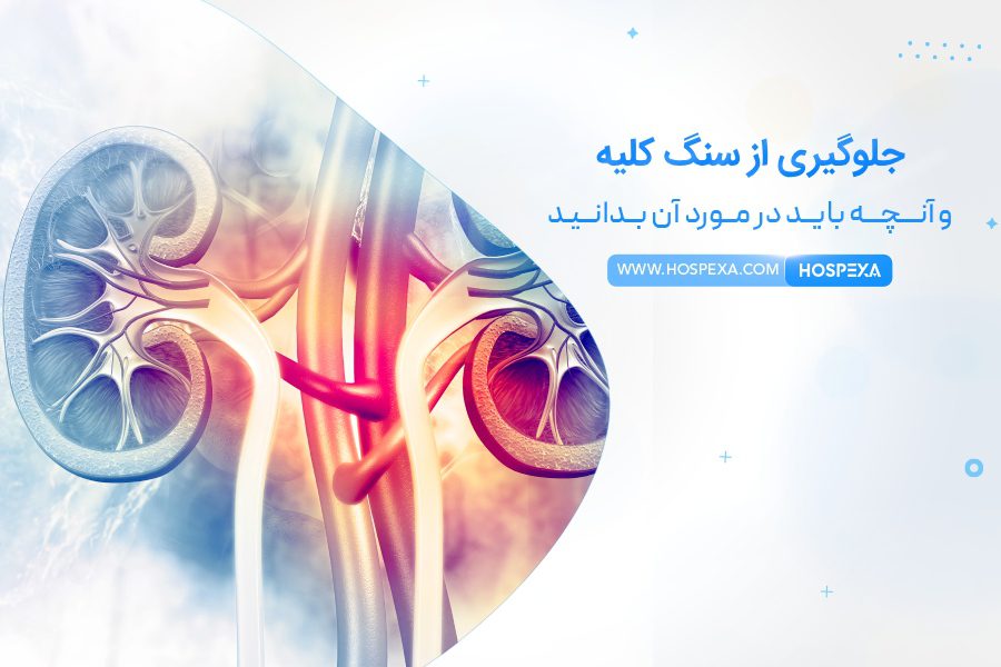 چگونه از سنگ کلیه جلوگیری کنیم؟ جلوگیری از سنگ کلیه