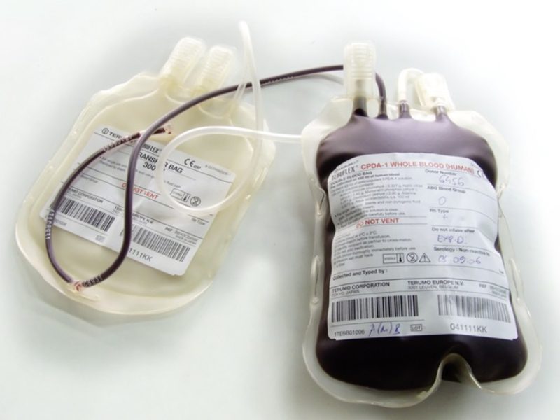 کیسه فصد خون