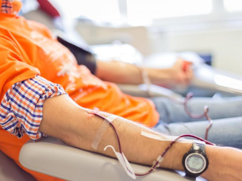 فصد خون برای کبد چرب روش انجام فصد خون برای کبد چرب