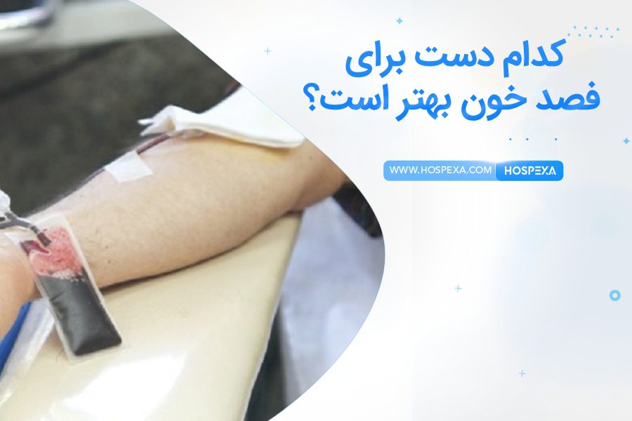 فصد خون از کدام دست بهتر است؟ فصد خون از دست راست