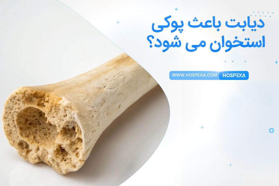 دیابت پوکی استخوان را افزایش می دهد؟