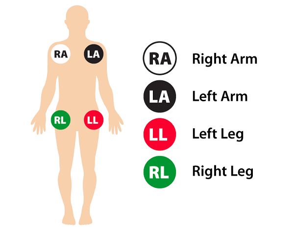 شیوه لیدگذاری دستگاه ECG - از سیر تا پیاز دستگاه الکتروکاردیوگرام (ECG)