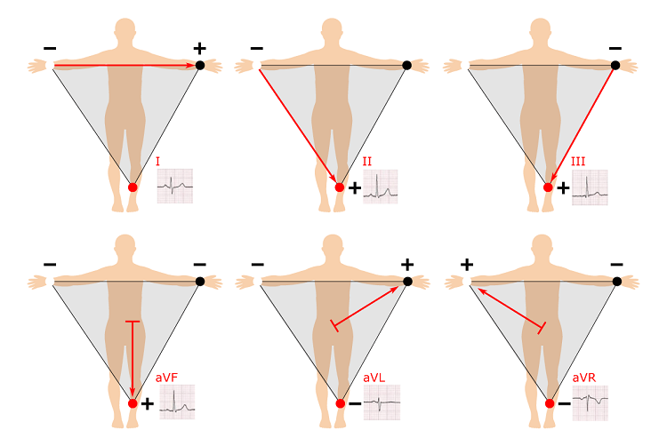 Einthovens Triangle - از سیر تا پیاز دستگاه الکتروکاردیوگرام (ECG)