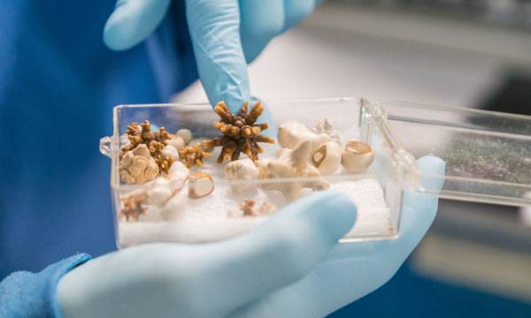 پیشگیری از سنگ کلیه جلوگیری از سنگ کلیه