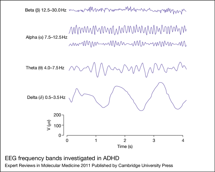 نوار مغزی و ریتم های EEG انسان