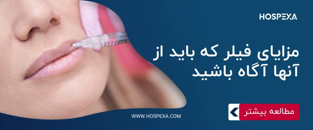 مزایا و معایب فیلر صورت مزایا و معایب تزریق فیلر
