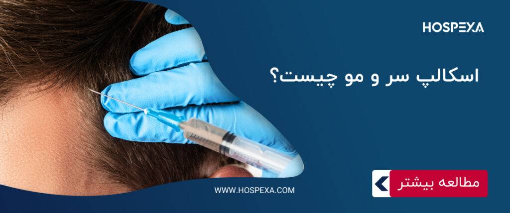 اسکالپ سر چیست؟ موی سر