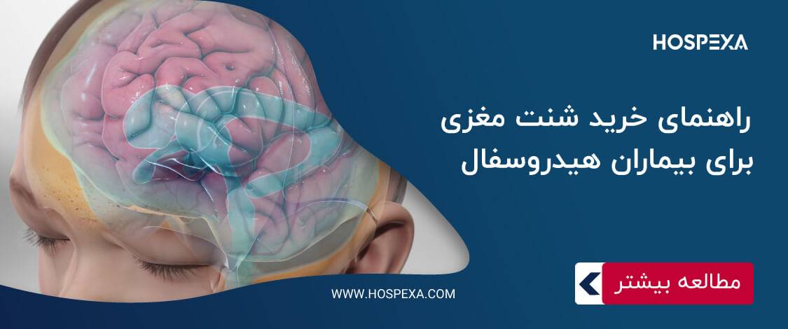 راهنمای خرید شنت مغزی برای بیماران هیدروسفال 1 - راهنمای خرید شنت مغزی برای بیماران هیدروسفال