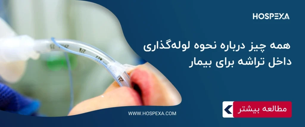 اینتوبه کردن