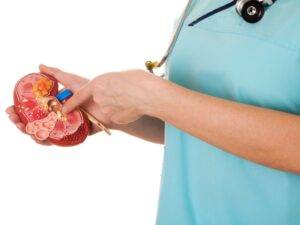 درمان سنگ کلیه بهترین درمان سنگ کلیه