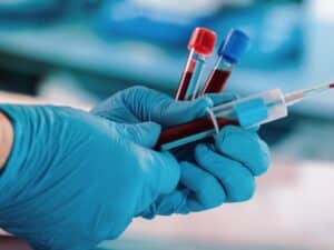 فصد خون چیست؟ فواید و مضرات آن فواید فصد خون