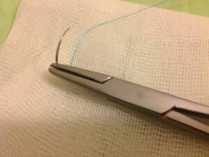 تفاوت سوزن گیر و هموستات