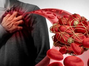 غلظت خون شدید