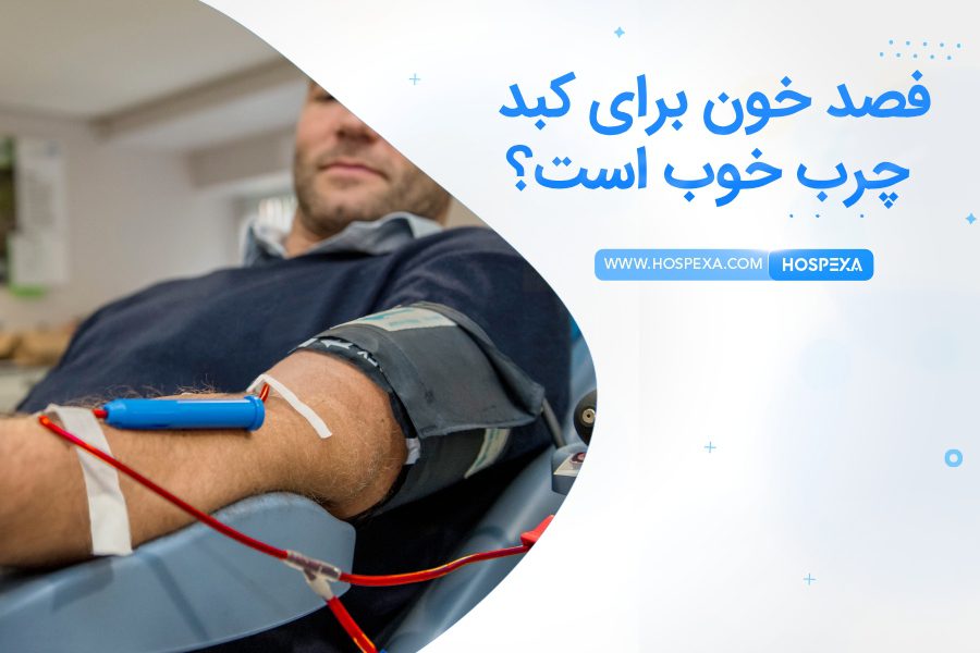 فصد خون برای کبد چرب