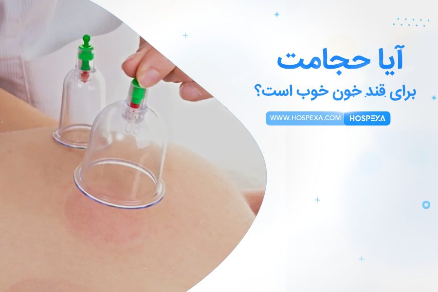 حجامت برای قند خون