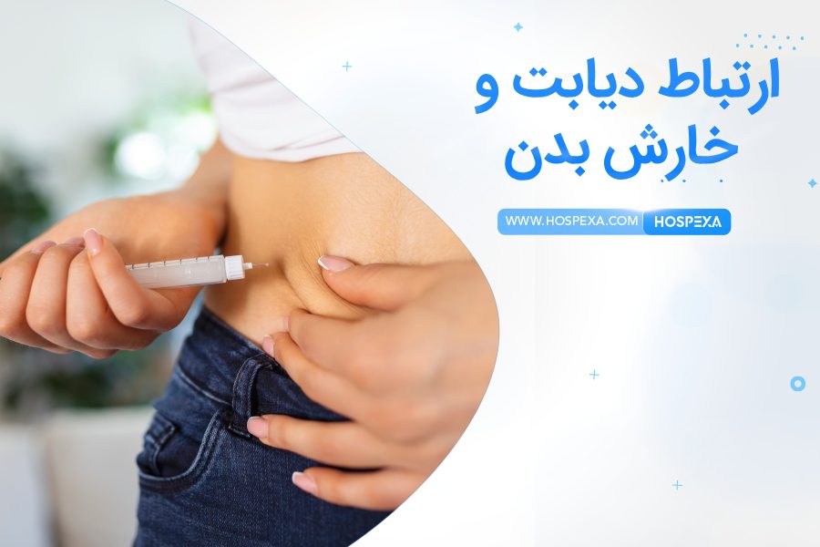 دیابت باعث خارش بدن می شود؟