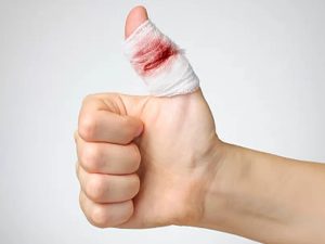 راهنمای اورژانسی بریدگی و خونریزیهای شدید بریدگی جزئی